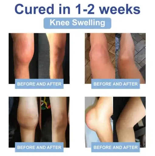 Black Rice Pain Healing Bone Cream - Image 11