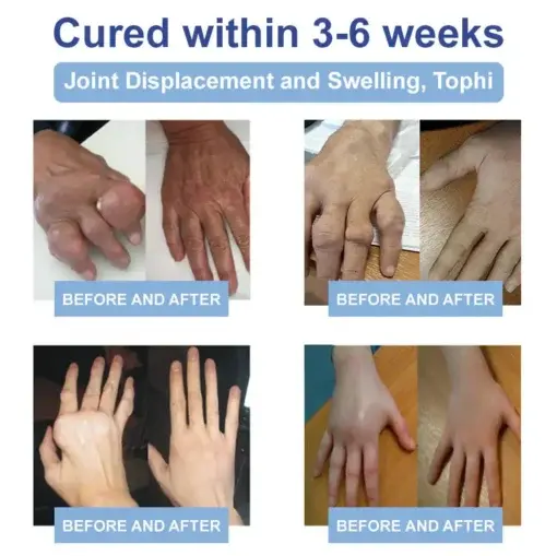 Black Rice Pain Healing Bone Cream - Image 13