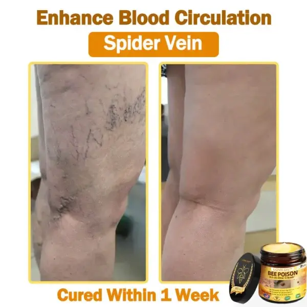 𝐁𝐞𝐞 Poison 𝐀𝐥𝐥-𝐢𝐧-𝐎𝐧𝐞 𝐂𝐫𝐞𝐚𝐦 - Image 10