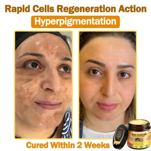 𝐁𝐞𝐞 Poison 𝐀𝐥𝐥-𝐢𝐧-𝐎𝐧𝐞 𝐂𝐫𝐞𝐚𝐦 - Image 8