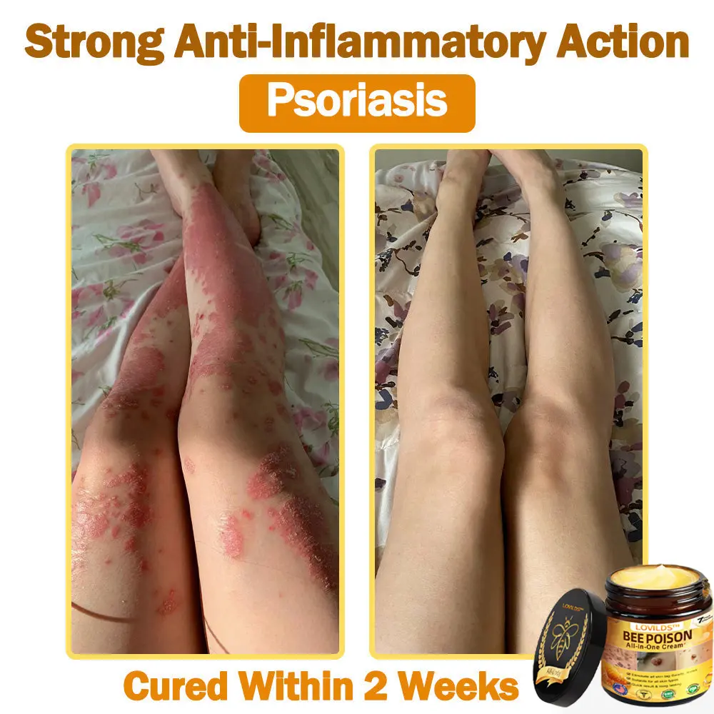 ๐๐๐ Poison ๐๐ฅ๐ฅ-๐ข๐ง-๐๐ง๐ ๐๐ซ๐๐๐ฆ - Image 9