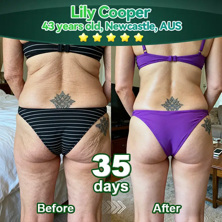 ๐๐ญ๐๐ฆ ๐๐๐๐ & ๐๐ผ๐๐๐๐ ๐๐ง ๐๐๐ฉ๐ญ๐ข๐๐ ๐๐ซ๐๐ ๐๐ซ๐ผ๐ฉ๐ฌ - Image 5