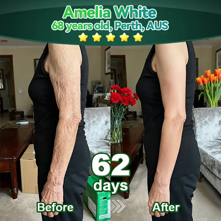 ๐๐ญ๐๐ฆ ๐๐๐๐ & ๐๐ผ๐๐๐๐ ๐๐ง ๐๐๐ฉ๐ญ๐ข๐๐ ๐๐ซ๐๐ ๐๐ซ๐ผ๐ฉ๐ฌ - Image 6