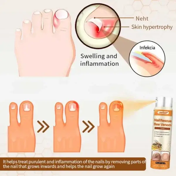 NailRescue Bee Wenom - Image 4