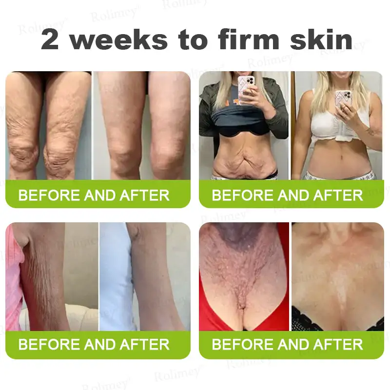 Botox & Vita-A Retinol Shot Tightening and Wrinkle-Reducing Cream - Image 9