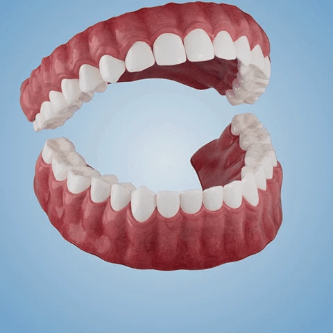 - Advanced Customized Full Denture Set - Image 6