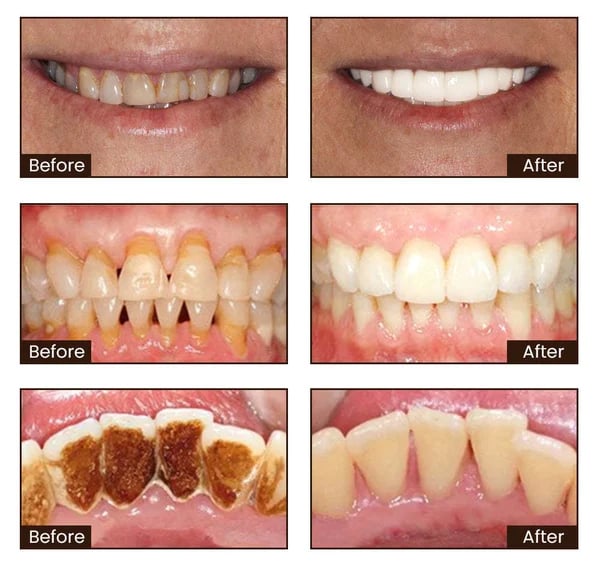 Niacinamide Intensive Whitening Toothpaste - Image 3