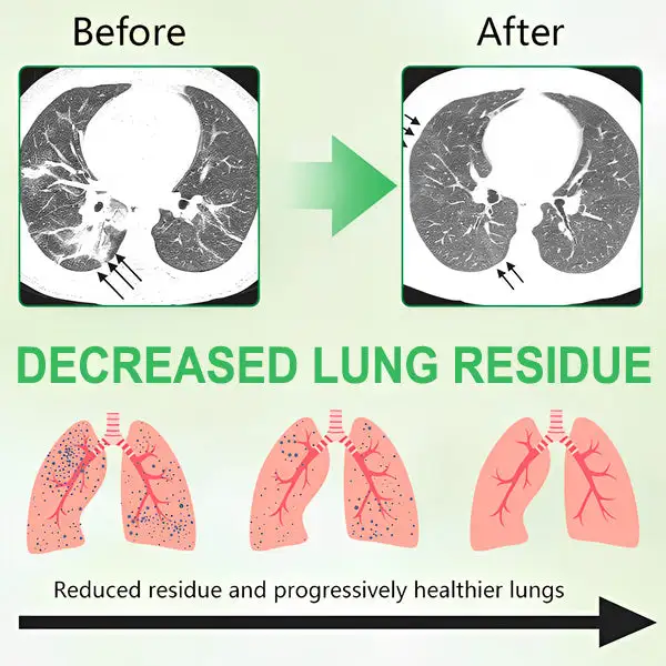 3X Concentrated Mullein Lung Cleanse Spray — Advanced Respiratory Detox & Clear Breathing - Image 3