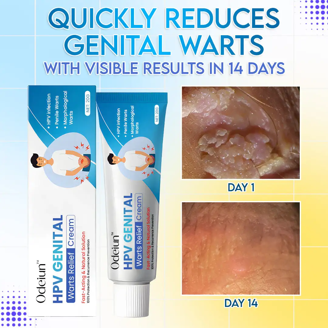 HPV Genital Warts Relief Cream - Image 3