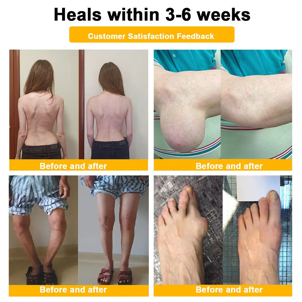 Bee Venom Pain Relief Joint Repair Cream - Image 20