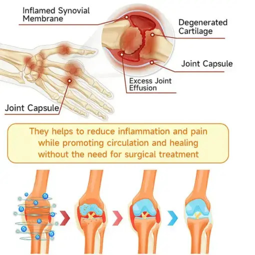 BEE VENOM LITHOSPERMUM Pain-Relief Bone Healing Cream - Image 10