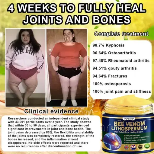 BEE VENOM LITHOSPERMUM Pain-Relief Bone Healing Cream - Image 8