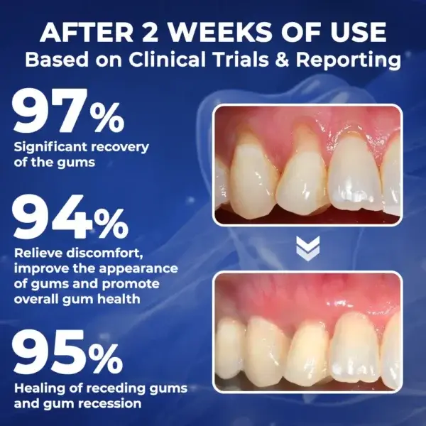 BeeTakt Bee Venom Dental Treatment Drops Mouthwash - Image 7