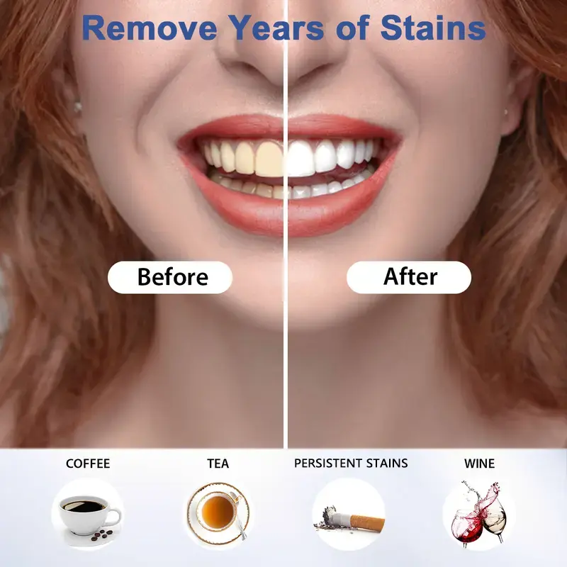 SmileFitPro 35%CP Teeth Whitening Pen - Image 2