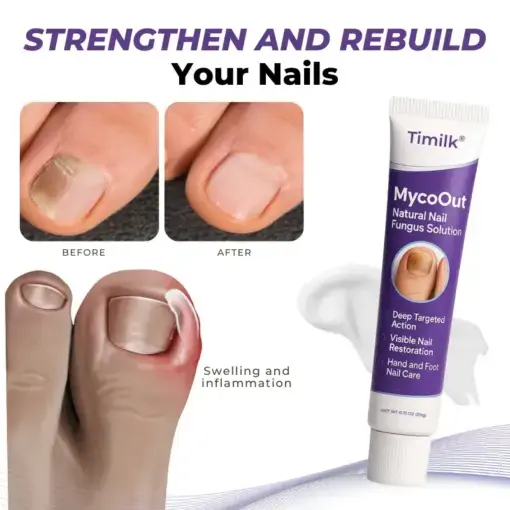 MycoOut Natural Nail Fungus Solution - Image 5