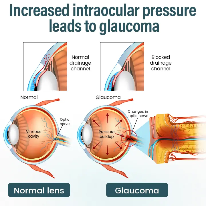 OptiFusion Nano Eye Drops Serum - Image 6