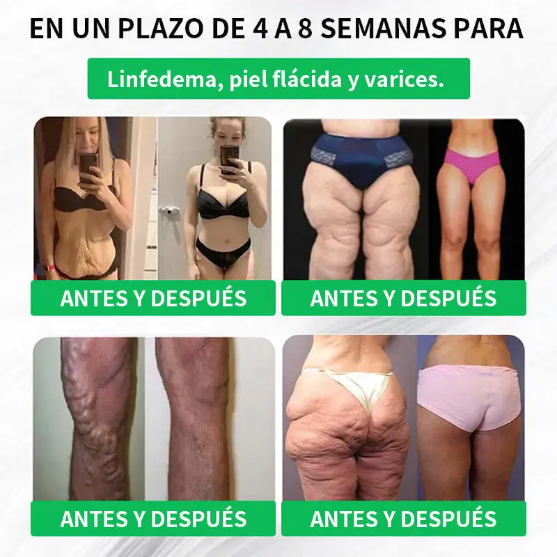 Berberine Slimming Support Nano Microneedle Patch - Image 5