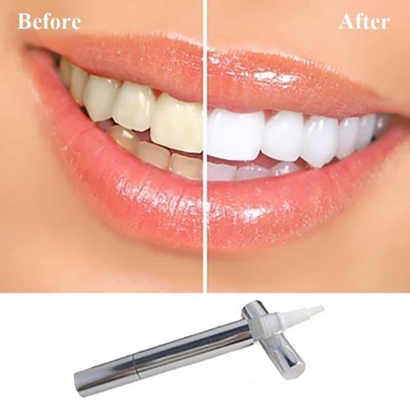 Teeth Whitening Pen - Image 2