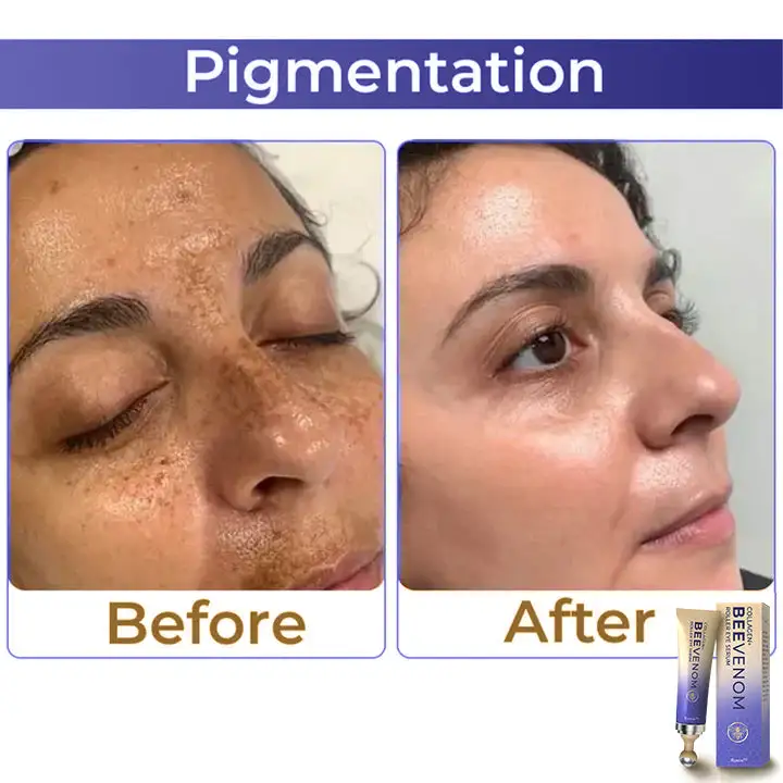 Collagen+ Bee Venom Roller Eye Cream - Image 5