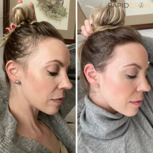 Alternative view of - Ginger Hair Growth Shampoo