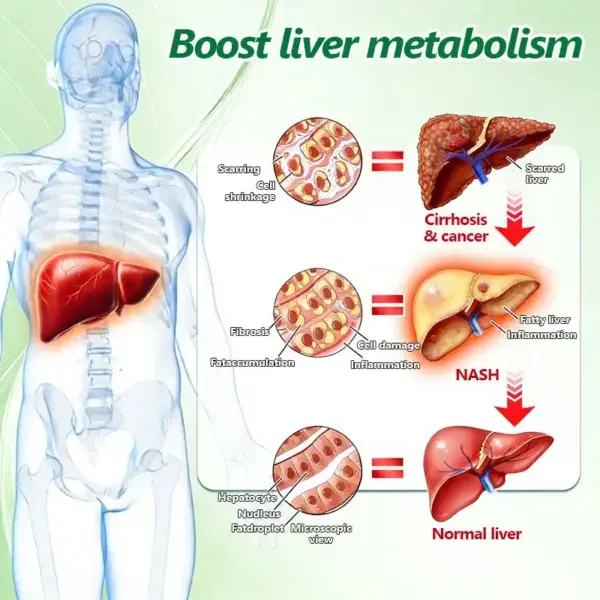 ๐๐ฒ๐ฟ๐ฏ๐ฒ๐ฟ๐ถ๐ป๐ฒ ๐๐-๐ข๐ง-๐ ๐ก๐ฎ๐ป๐ผ ๐ ๐ถ๐ฐ๐ฟ๐ผ๐ป๐ฒ๐ฒ๐ฑ๐น๐ฒ ๐ฃ๐ฎ๐๐ฐ๐ต - Image 15