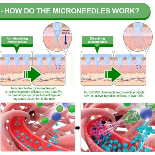 ๐๐ฒ๐ฟ๐ฏ๐ฒ๐ฟ๐ถ๐ป๐ฒ ๐๐-๐ข๐ง-๐ ๐ก๐ฎ๐ป๐ผ ๐ ๐ถ๐ฐ๐ฟ๐ผ๐ป๐ฒ๐ฒ๐ฑ๐น๐ฒ ๐ฃ๐ฎ๐๐ฐ๐ต - Image 16