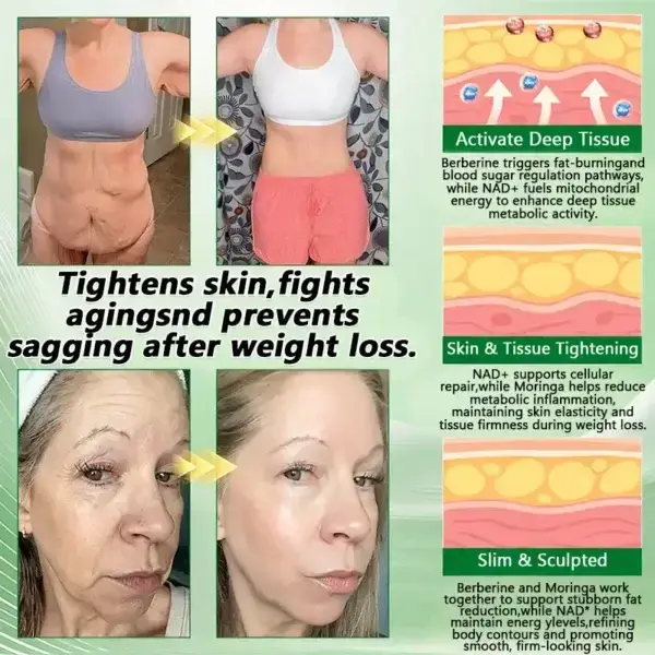 ๐๐ฒ๐ฟ๐ฏ๐ฒ๐ฟ๐ถ๐ป๐ฒ ๐๐-๐ข๐ง-๐ ๐ก๐ฎ๐ป๐ผ ๐ ๐ถ๐ฐ๐ฟ๐ผ๐ป๐ฒ๐ฒ๐ฑ๐น๐ฒ ๐ฃ๐ฎ๐๐ฐ๐ต - Image 8