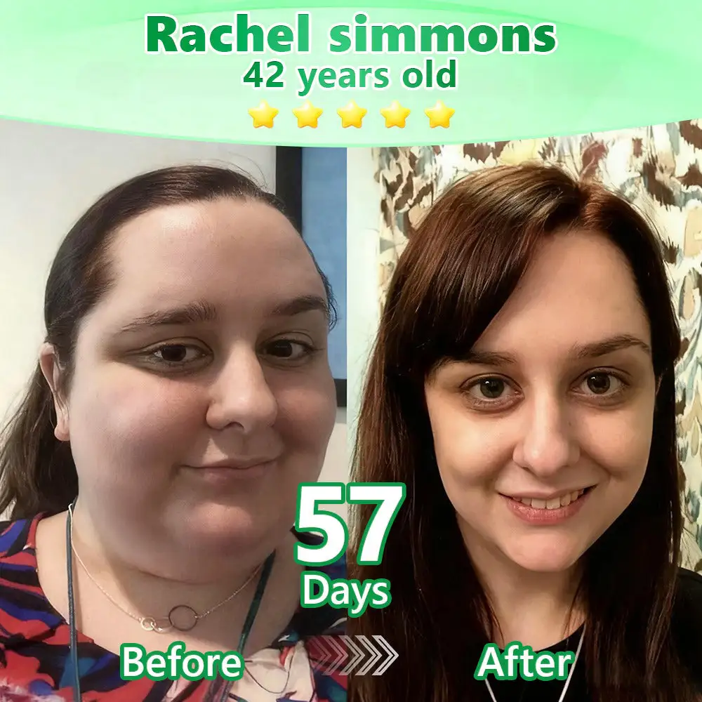 ๐๐ฒ๐ฟ๐ฏ๐ฒ๐ฟ๐ถ๐ป๐ฒ ๐ฒ-๐ถ๐ป-๐ญ ๐ก๐ฎ๐ป๐ผ ๐ ๐ถ๐ฐ๐ฟ๐ผ๐ป๐ฒ๐ฒ๐ฑ๐น๐ฒ ๐ฃ๐ฎ๐๐ฐ๐ต - Image 2