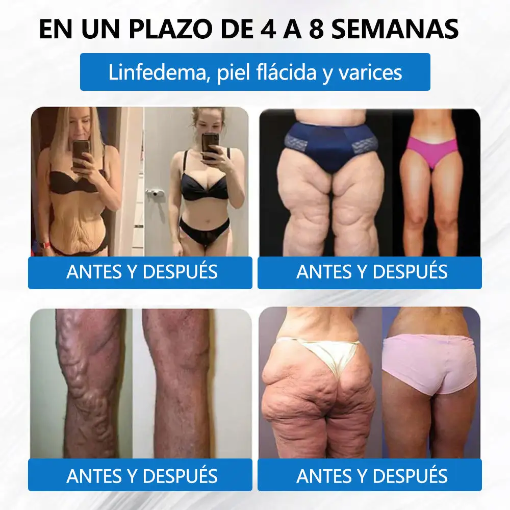 ๐-๐๐-๐ ๐๐๐ญ๐๐๐จ๐ฅ๐ข๐ & ๐
๐ข๐ซ๐ฆ๐ข๐ง๐ ๐๐๐ญ๐๐ก - Image 4