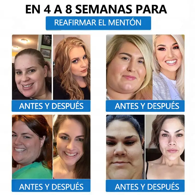 ๐-๐๐-๐ ๐๐๐ซ๐๐ก๐ ๐๐๐ญ๐๐๐จฬ๐ฅ๐ข๐๐จ & ๐๐๐๐๐ข๐ซ๐ฆ๐๐ง๐ญ๐ - Image 5