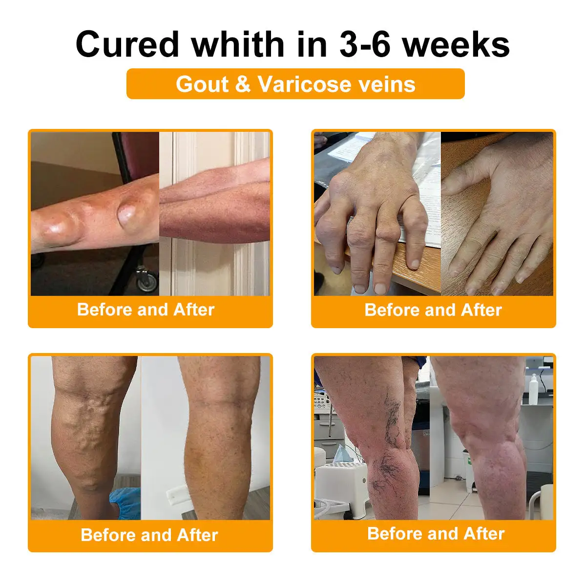 Botulinum Toxin and Bee Venom Pain Relief Bone Healing Cream - Image 16