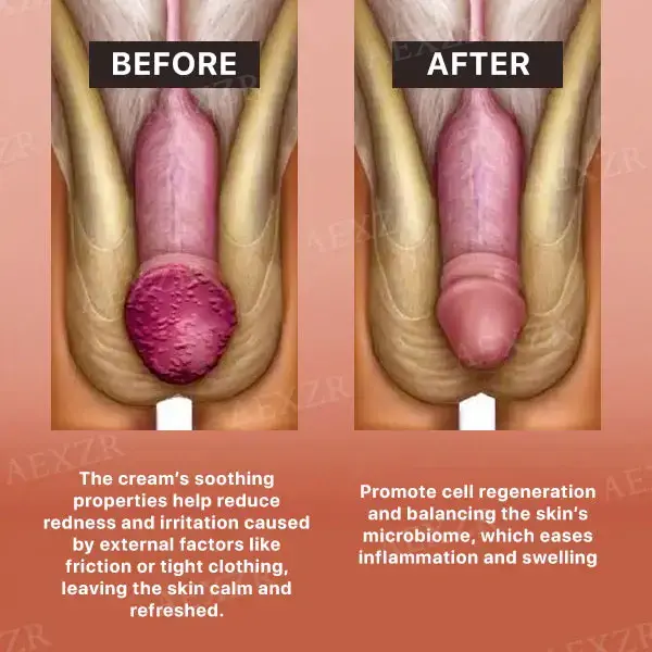 Glans Care Cream - Image 4