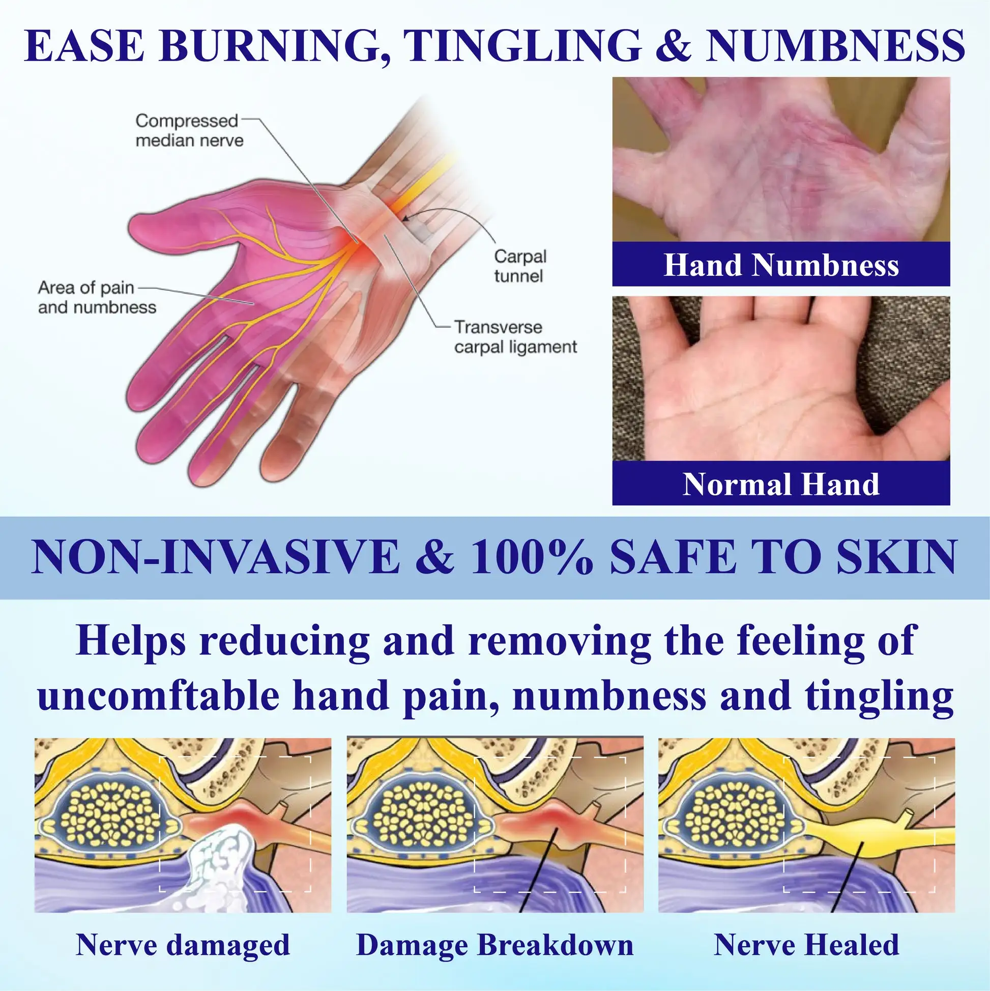 NumbAway CoolEase Neuropathy Spray - Image 3