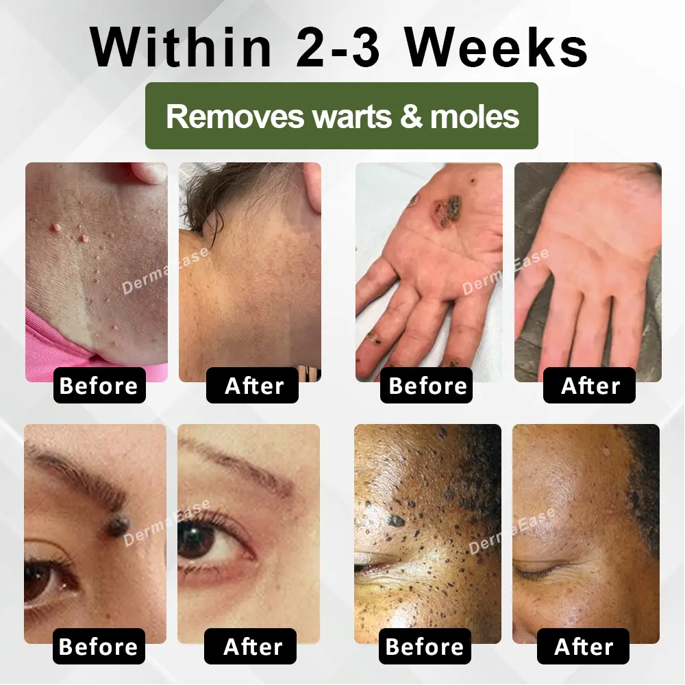 Skin Clear Herbal Jelly Gel - Image 2