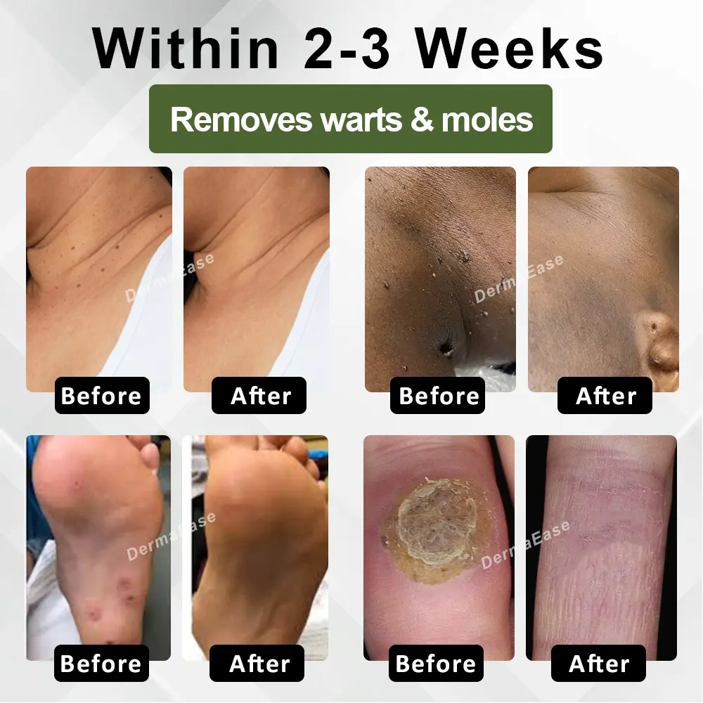 Skin Clear Herbal Jelly Gel - Image 3