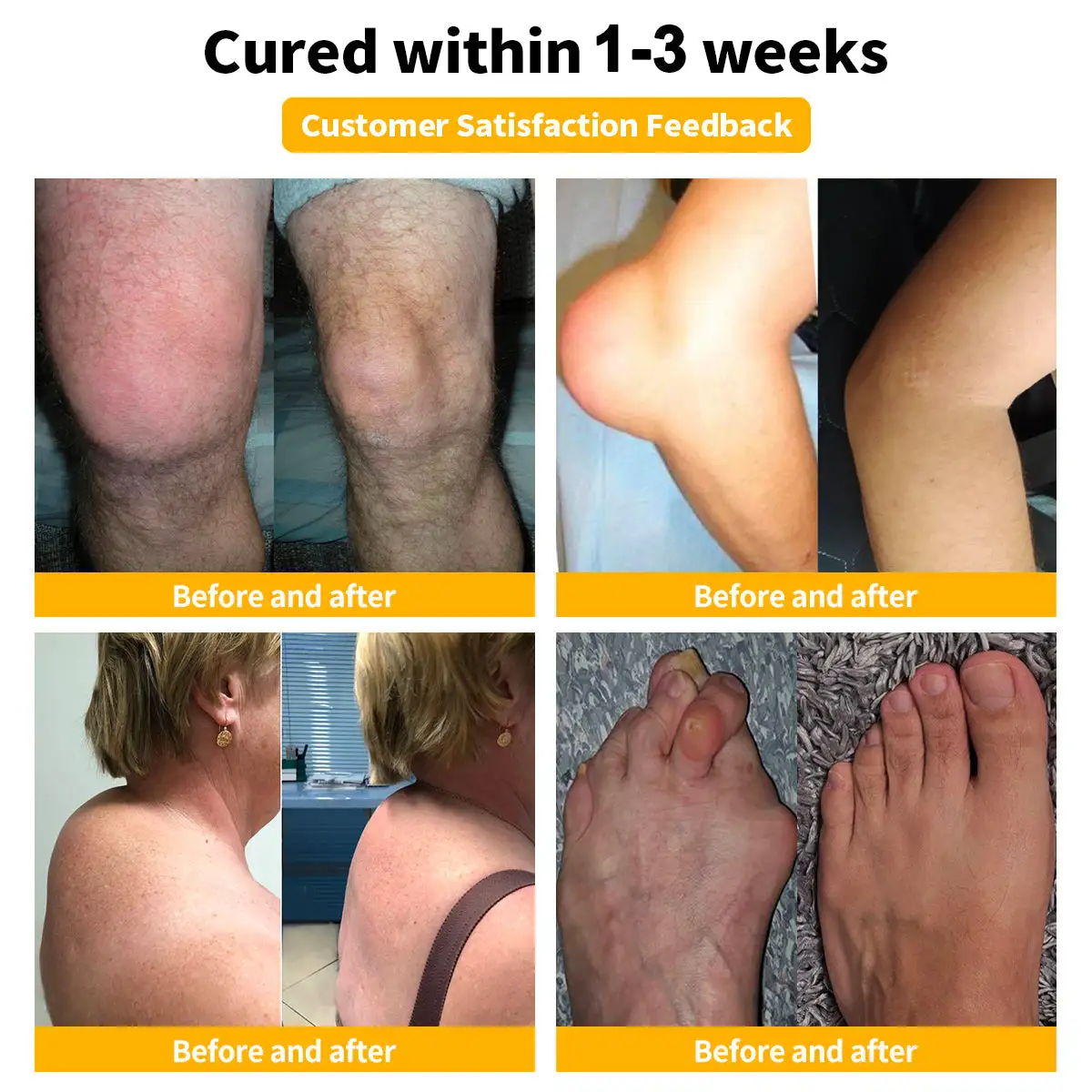 Bee Venom Advanced Joint and Bone Therapy Cream - Image 2