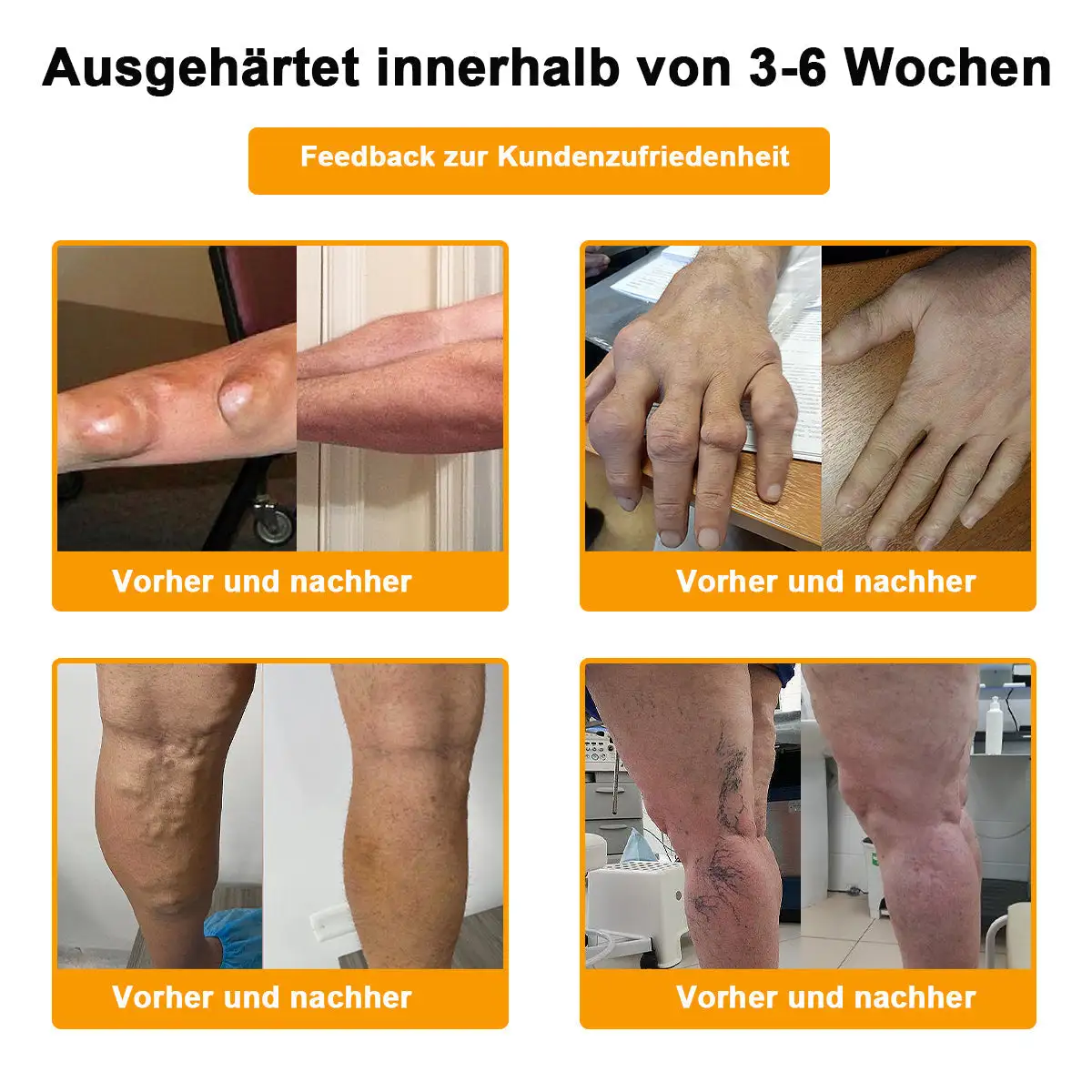 Bee-Venom Pain-Relief Bone Healing Cream - Image 17