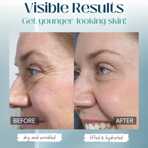 Protein Lifting Thread - Image 3