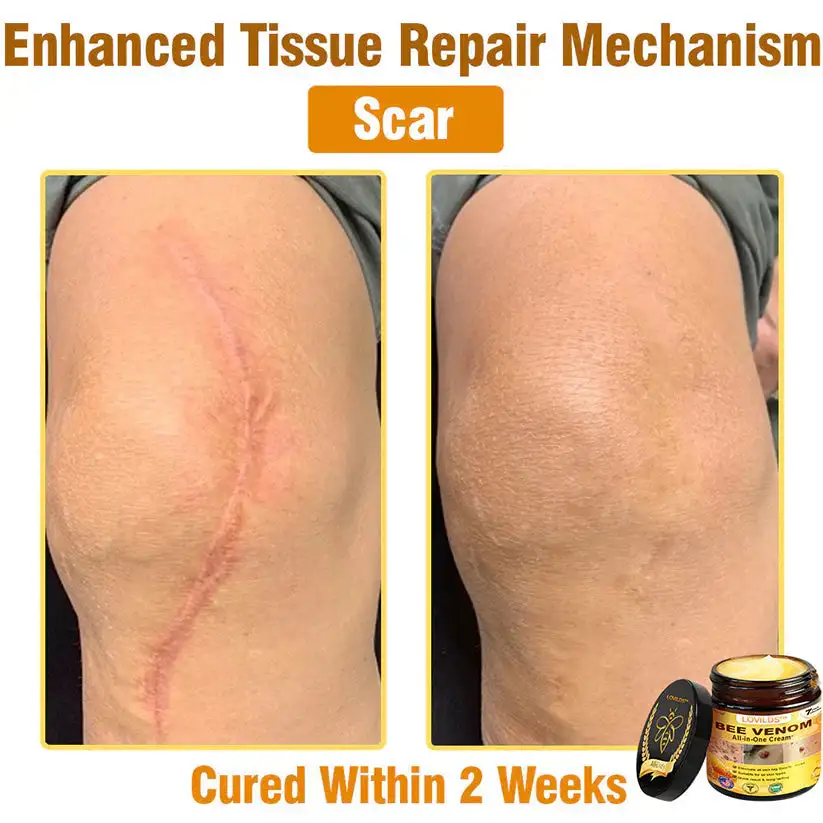 πππ πππ§π¨π¦ ππ₯π₯-π’π§-ππ§π ππ«πππ¦βAnti-Aging, Hydrating & Skin Repair - Image 13