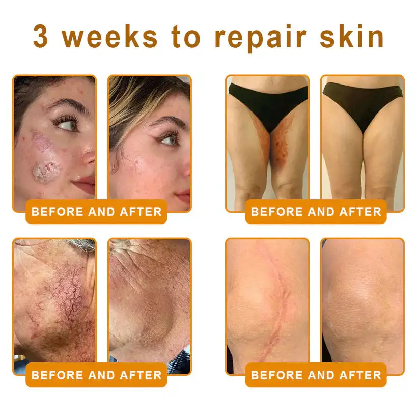 πππ πππ§π¨π¦ ππ₯π₯-π’π§-ππ§π ππ«πππ¦βAnti-Aging, Hydrating & Skin Repair - Image 4