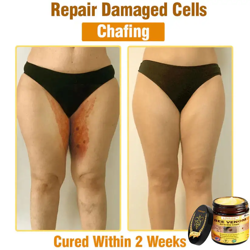 πππ πππ§π¨π¦ ππ₯π₯-π’π§-ππ§π ππ«πππ¦βAnti-Aging, Hydrating & Skin Repair - Image 9