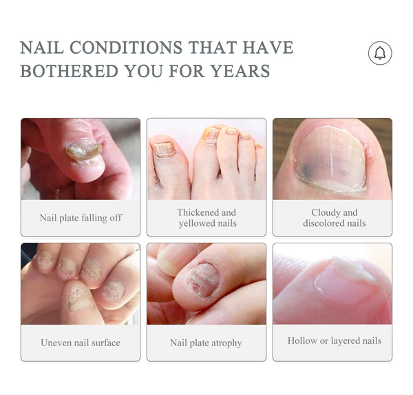 Nail Treatment Serum Pen - Image 6