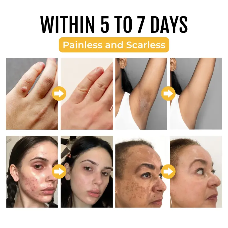 PapilloClear Bee Venom Skin Treatment Cream - Image 4