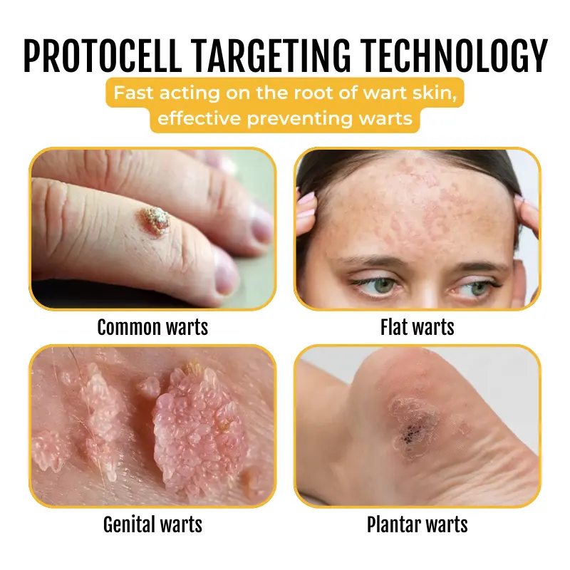 PapilloClear Bee Venom Skin Treatment Cream - Image 6