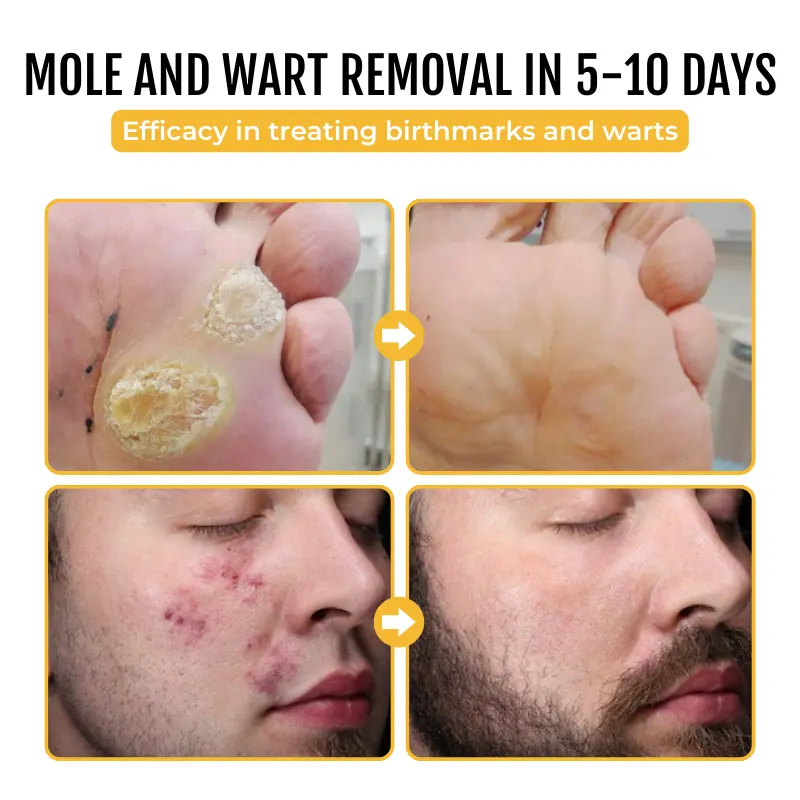 PapilloClear Bee Venom Skin Treatment Cream - Image 7