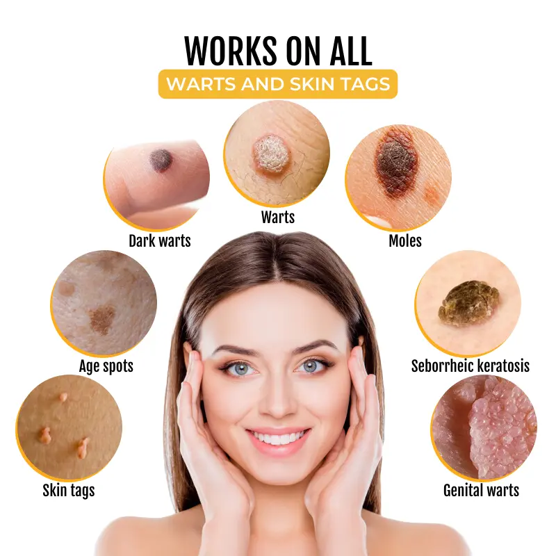 PapilloClear Bee Venom Skin Treatment Cream - Image 8