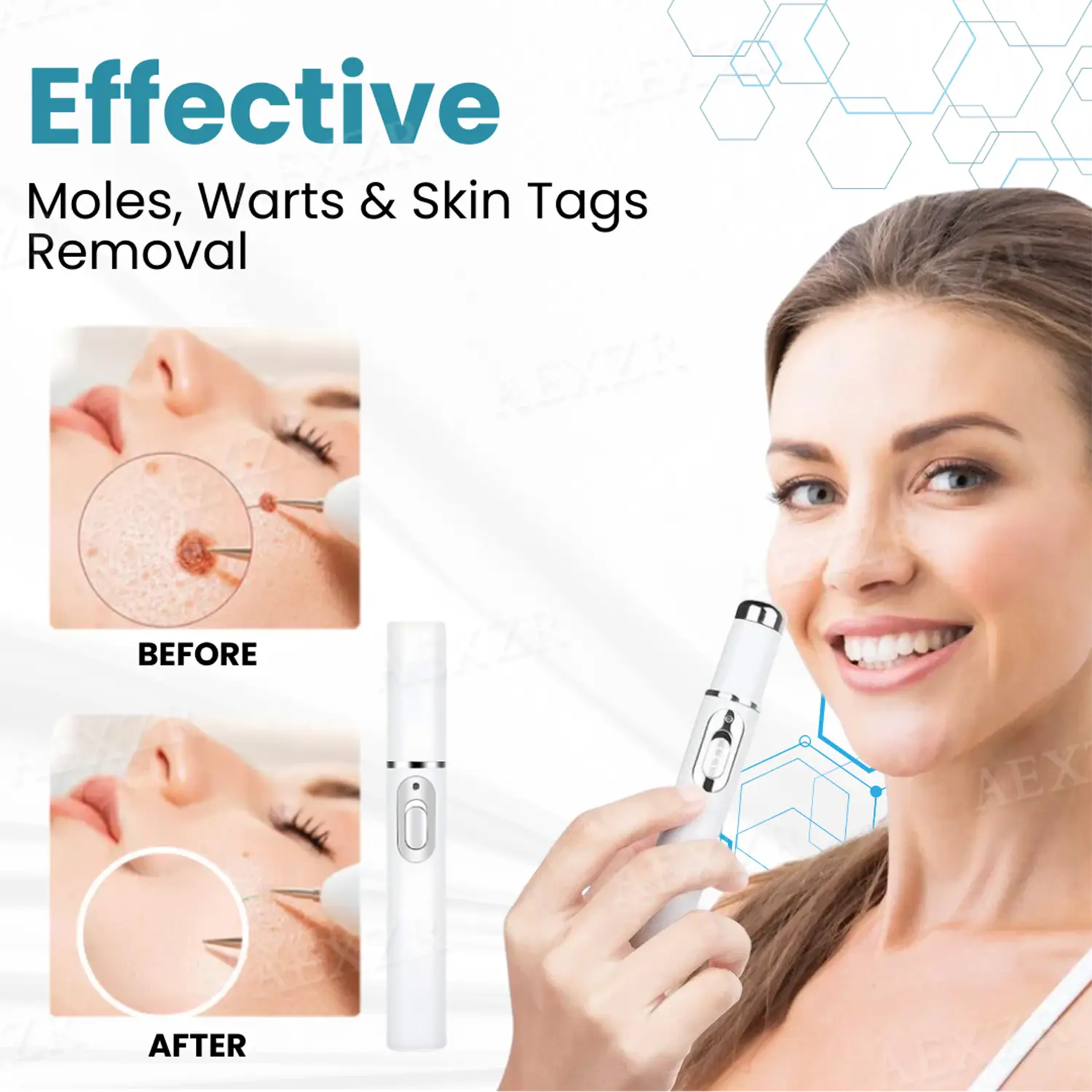 PRO Non-Invasive Mole and Wart Removal Laser Pen - Image 4