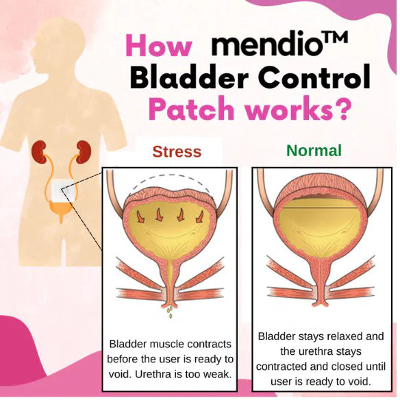 Bladder Control Patch - Image 5