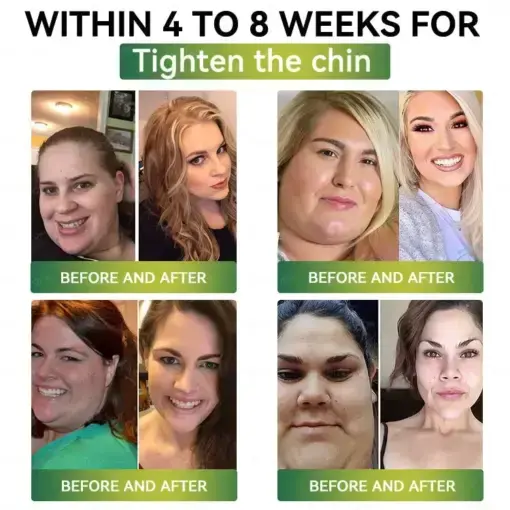 Microneedle Patch with Collagen Peptides & Matrixyl 3000 - Image 8