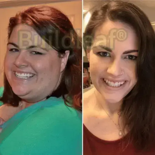 Microneedle Patch with Collagen Peptides & Matrixyl 3000 - Image 9